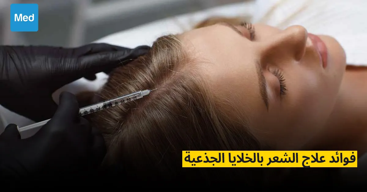 فوائد علاج الشعر بالخلايا الجذعية